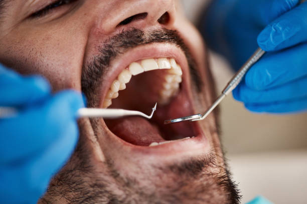 Best Pediatric Emergency Dentist in Lincoln Park, MI